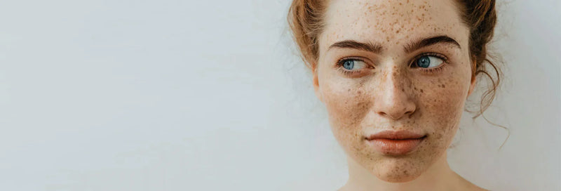 Pigmentation & Uneven Skin Tone